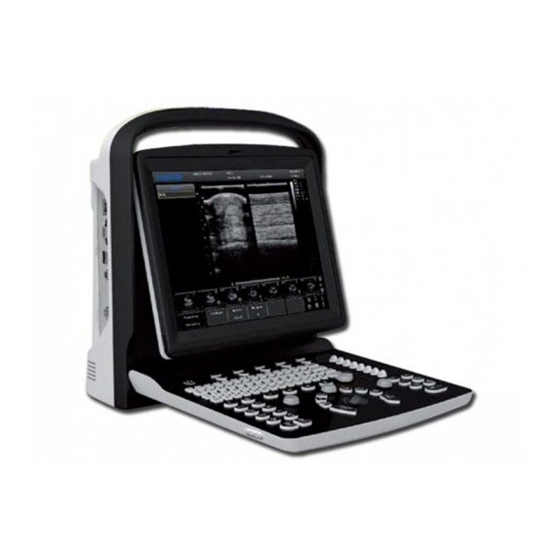 Chison ECO 1 Portable Ultrasound machine