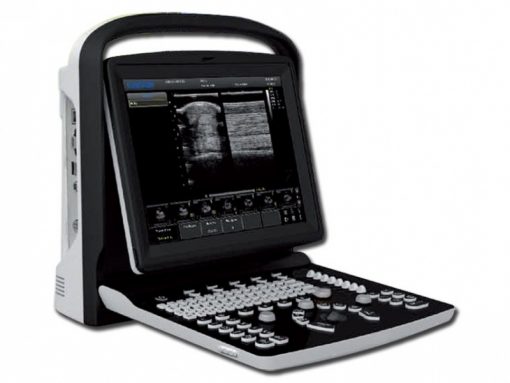 Chison ECO 1 Expert Portable Color Ultrasound machine